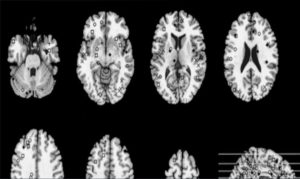 Brains